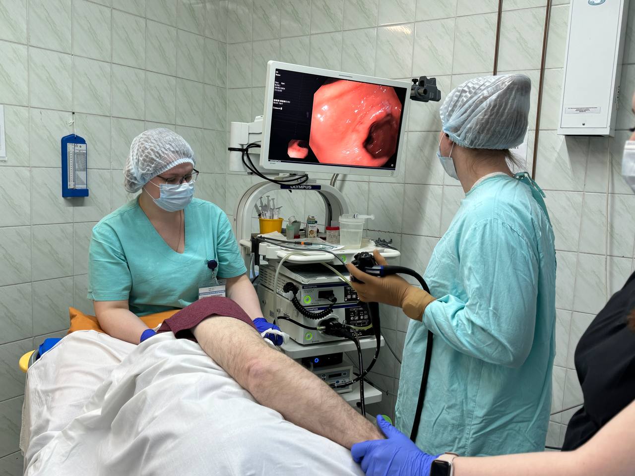 Врачи-эндоскописты окружной больницы Нижневартовска прооперировали пациента с “арбузным желудком”.